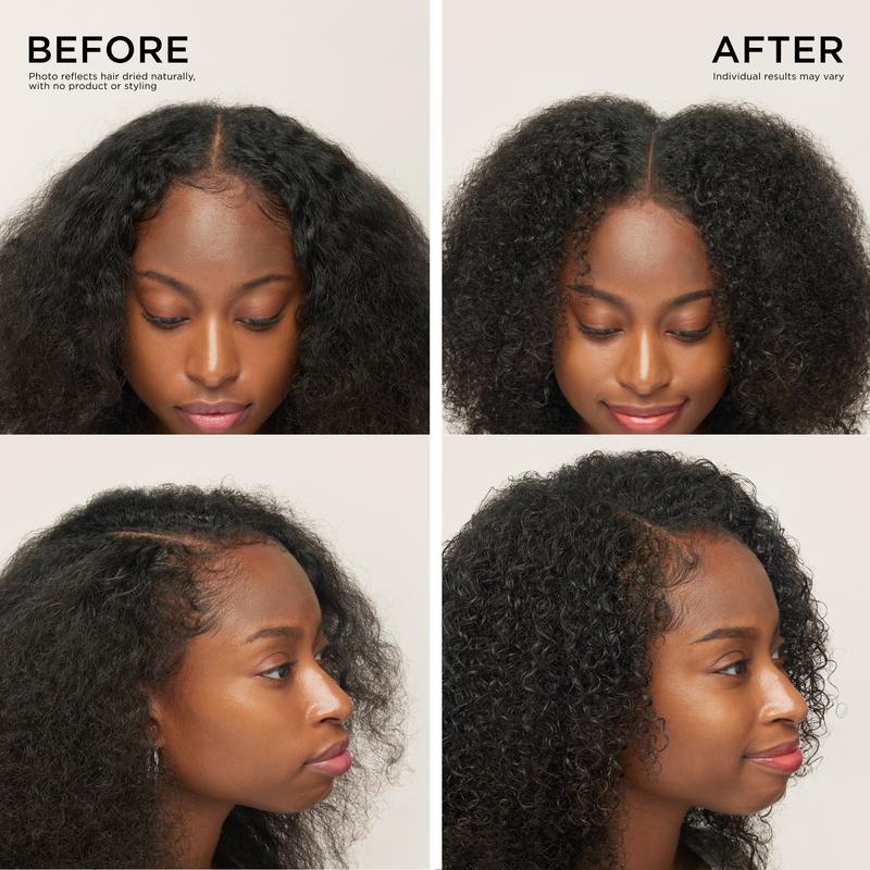 Advanced Hair Growth Roll-On Serum