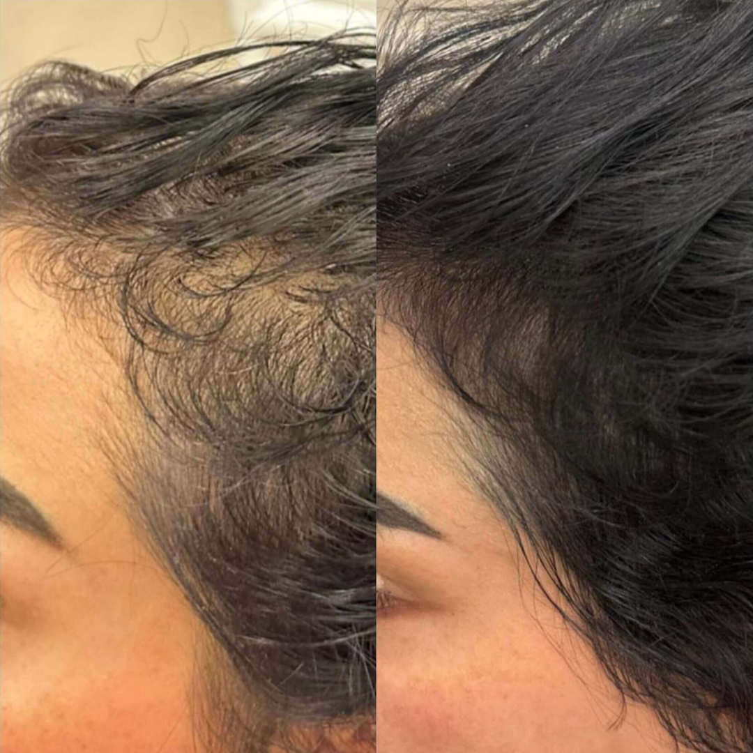 Advanced Hair Growth Roll-On Serum