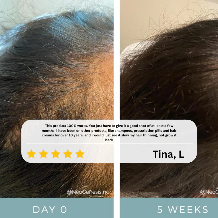 Advanced Hair Growth Roll-On Serum