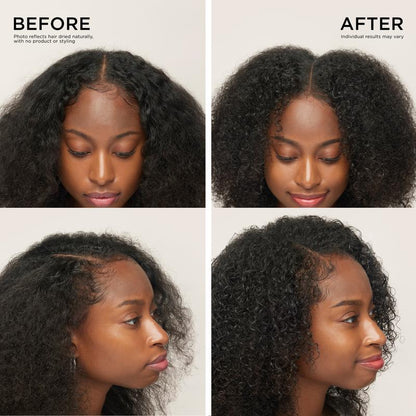 Advanced Hair Growth Roll-On Serum